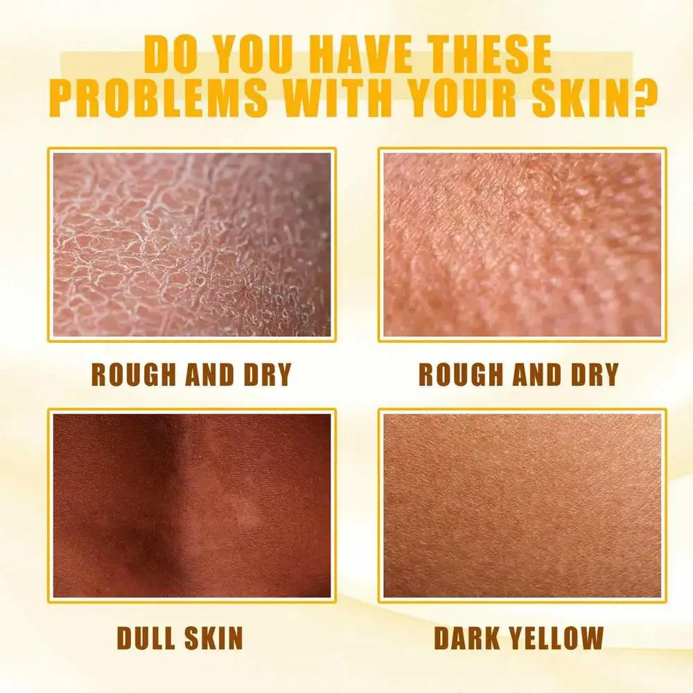Yellow Peeling Oil – Skin Lightening & Melanin Treatment for Elbows, Knees, Hands, and Even Skin Tone