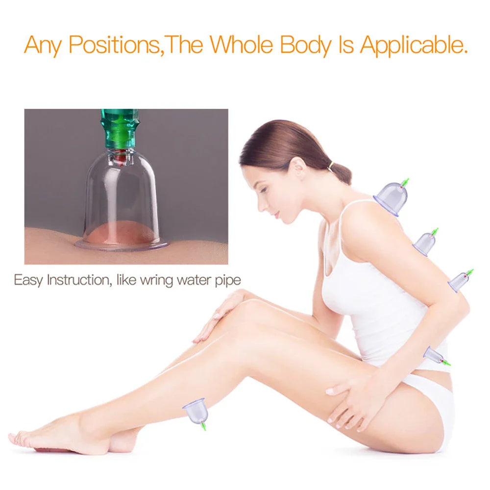 12/24-Cup Chinese Vacuum Cupping Therapy Set – Pull-Out Suction Massager for Pain Relief & Muscle Relaxation