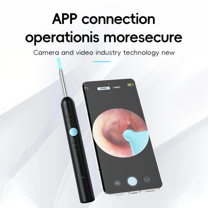 Smart Visual Ear Cleaner Set with 1080P Camera – WiFi Ear Wax Removal Tool with HD LED Lights & Earpick Endoscope