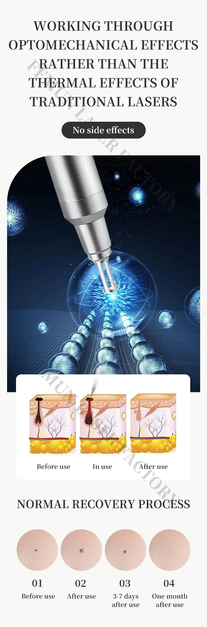 2-in-1 808nm Diode Laser Hair Removal & Picosecond Tattoo Machine – Portable 4000W Q-Switched Device