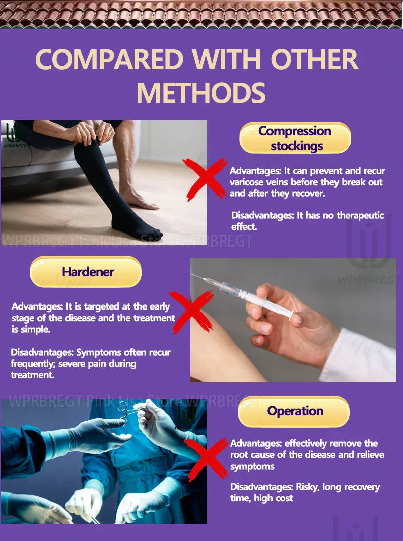 Varicose Vein & Spider Leg Pain Relief Treatment — Painless Care for Vasculitis & Phlebitis