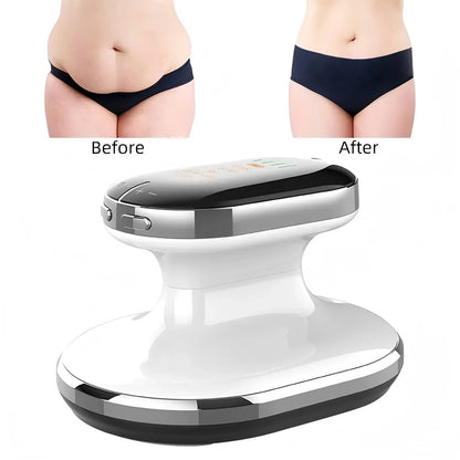 EMS Portable Body Slimming Machine – LED Fat Burner & Anti-Cellulite Massager for Weight Loss & Body Shaping