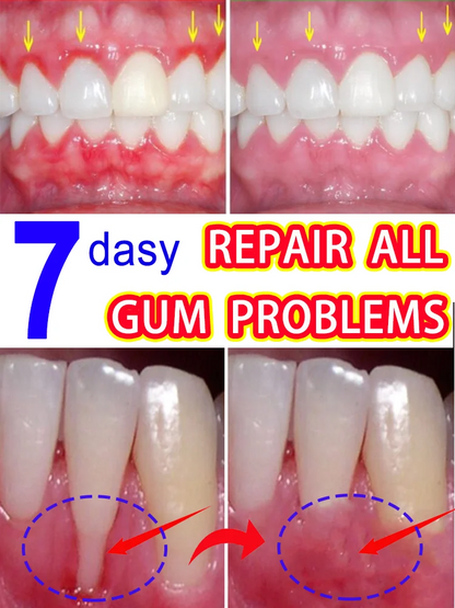 Effective Gum Repair – Relieve Toothache, Strengthen Teeth & Gum Health