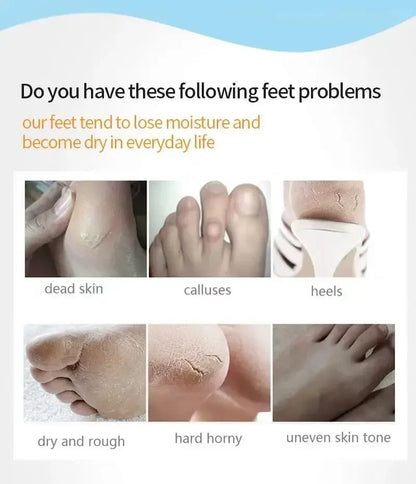 Honey Foot Mask – 1 Pair for Dead Skin & Callus Removal, Exfoliating Foot Treatment, Whitening Foot Spa & Skin Care Tool
