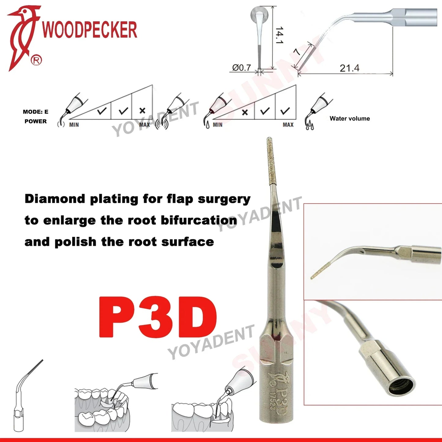Woodpecker Dental Scaler Tips – Ultrasonic Tooth Cleaning, Endo & Perio Scaling Tips, Fit EMS UDS Scaler Handpiece