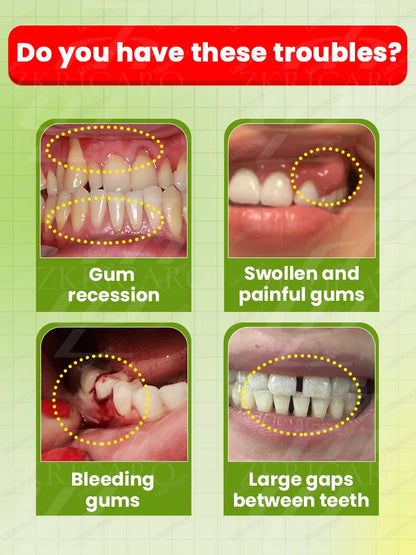 2025 Advanced Gum Care Device — Powerful Technology to Eliminate Gum Recession, Bleeding, and Tooth Pain