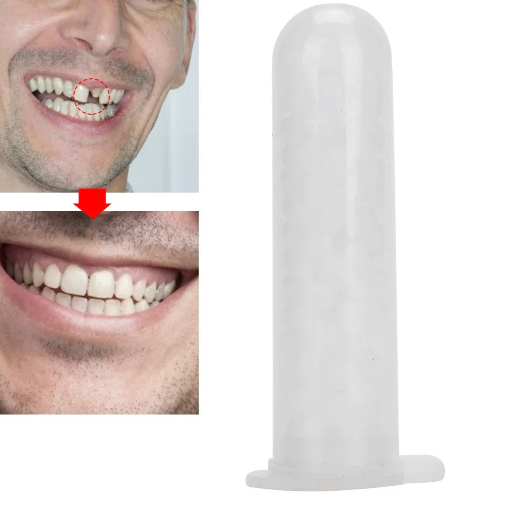 20g Temporary Tooth Repair Bead – Food Grade Plastic Dental Filling Material for Broken Teeth & Dentures