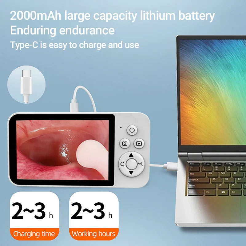 DDCAMERA 4.3" Digital Otoscope – 1080P Ear Scope with 6 LED Lights for Ear Wax Removal, Photo & Video Support