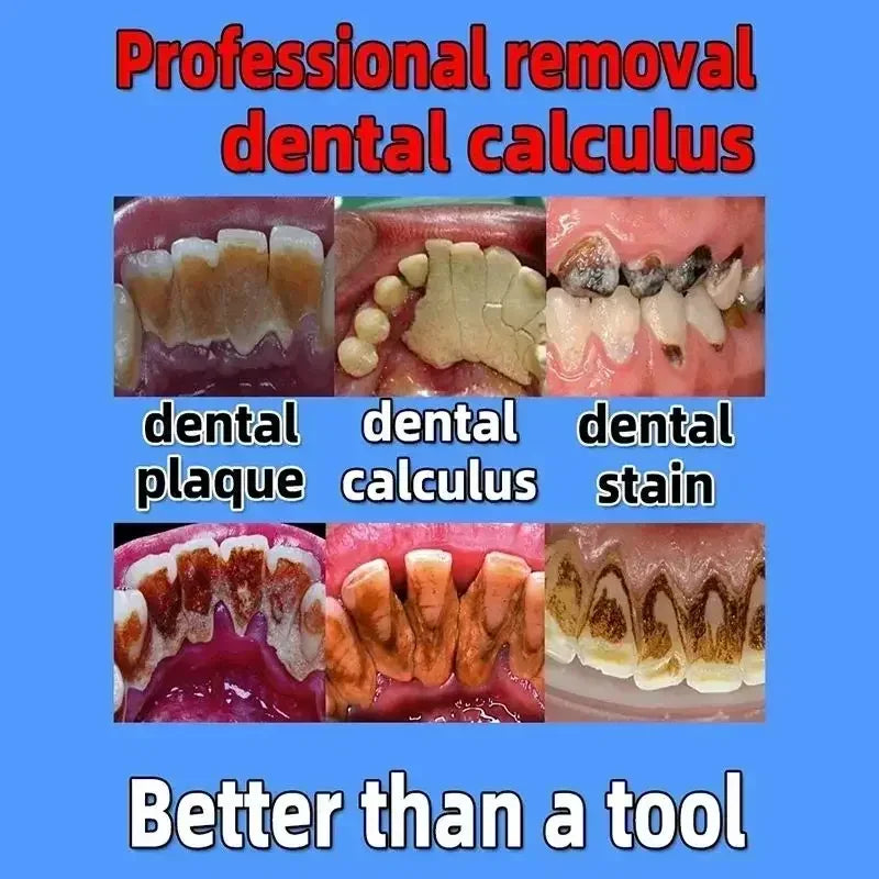 Dental Calculus Remover & Whitening Toothpaste – Fresh Breath & Periodontitis Prevention