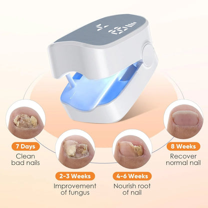 Rechargeable Infrared Nail Fungus Treatment Device – Effective Toenail Fungal Infection Removal Machine for Nail Care