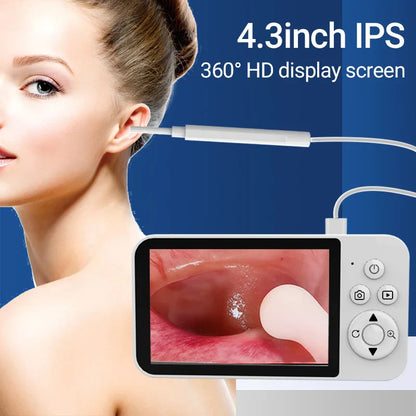 DDCAMERA 4.3" Digital Otoscope – 1080P Ear Scope with 6 LED Lights for Ear Wax Removal, Photo & Video Support