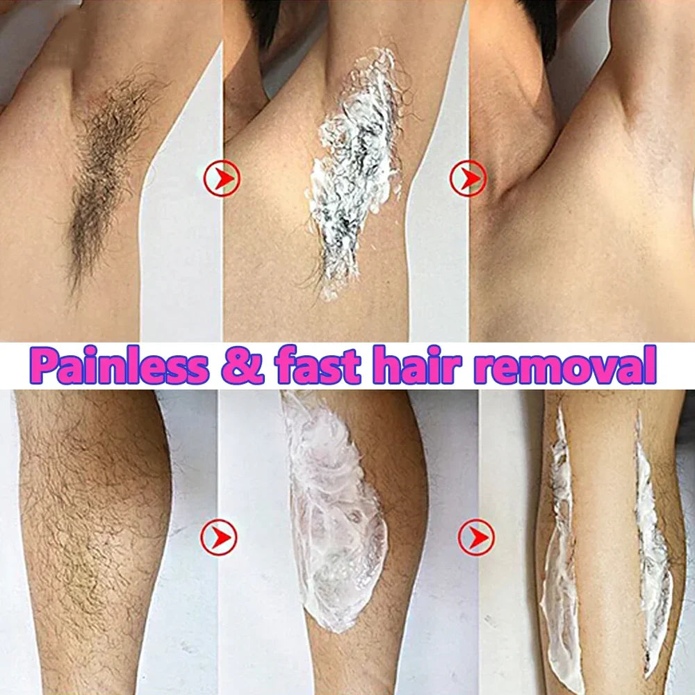 Permanent Hair Removal Cream — Painless Body & Intimate Area Epilator with Growth Inhibitor for Men & Women