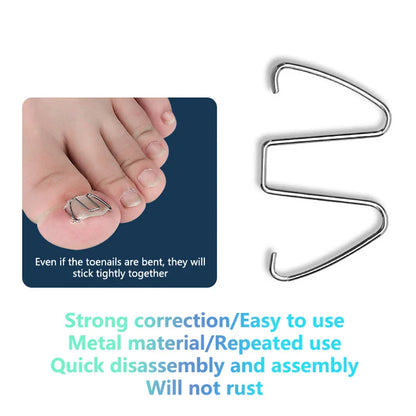 Ingrown Toenail Correction Tool Kit – Stainless Steel Nail Straightening Hook & Clip for Paronychia Treatment Pedicure Care