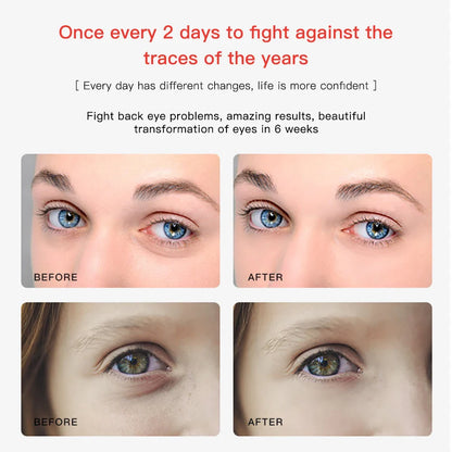 Portable 2 in 1 EMS Eye & Face Vibration Massager - Dark Circle Remover & Anti-Aging Eye Wrinkle Beauty Care Tool