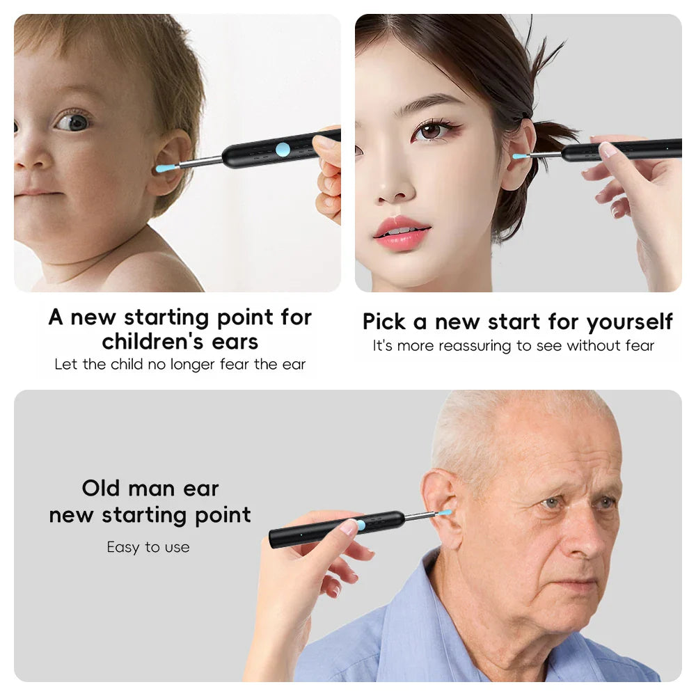 Smart Visual Ear Cleaner Set with 1080P Camera – WiFi Ear Wax Removal Tool with HD LED Lights & Earpick Endoscope