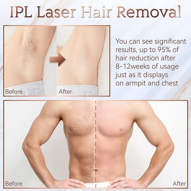 IPL Laser Hair Removal Device – 999,999 Flashes Painless Epilator for Women, Permanent At-Home Bikini & Body Hair Removal