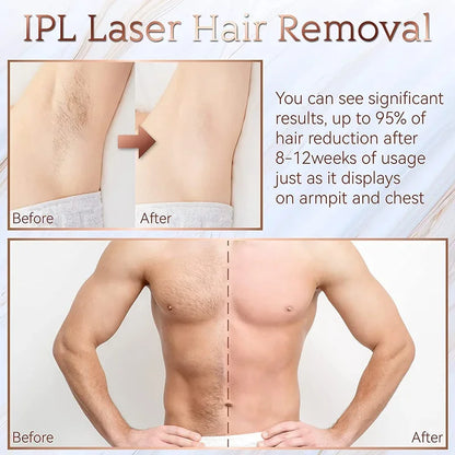 IPL Laser Hair Removal Device – 999,999 Flashes Painless Epilator for Women, Permanent At-Home Bikini & Body Hair Removal
