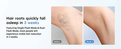 IPL Hair Removal Laser 22J — Unlimited Flashes IGBT, 5.2cm² Light Painless Epilator for Face, Armpit & Bikini Body Treatment