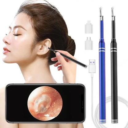 3-in-1 Smart Ear Cleaner Endoscope with Earwax Remover & Otoscope - 5.5mm, Android/PC Type-C Compatibility