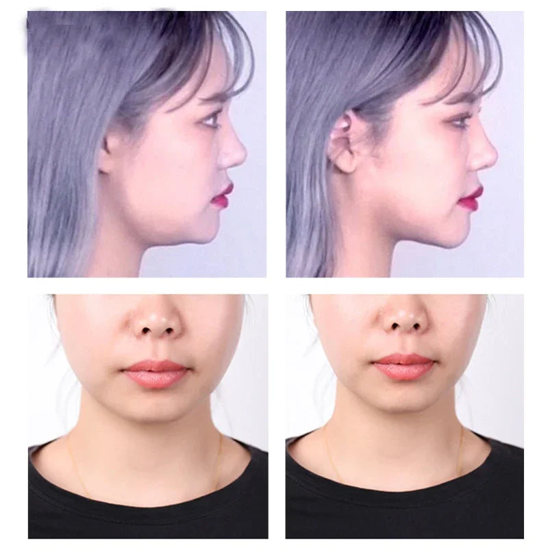40-120PCS V-Shape Face Lifting Tape — Invisible Transparent Adhesive Patches for Wrinkle & Sagging Skin Repair