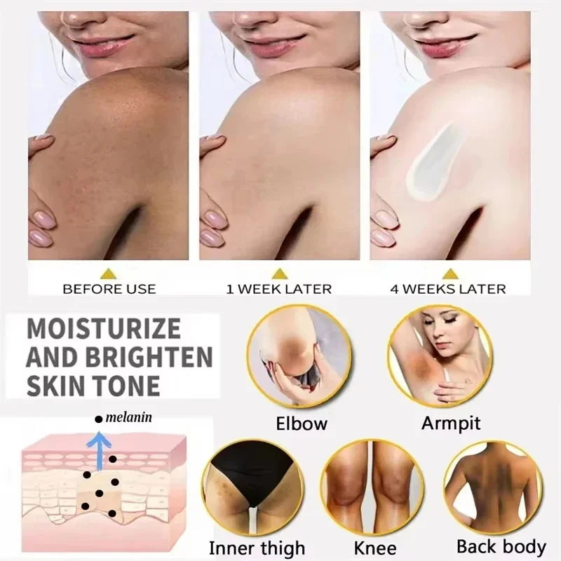 Body Whitening Cream for Arms, Thighs, Underarms & Knees – Brightening Moisturizing Essence for Even Tone Skincare Treatment
