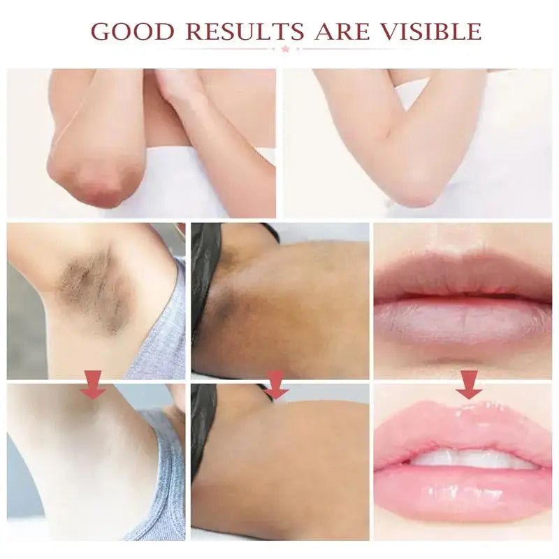 Whitening Body Cream for Underarm & Intimate Areas – Skin Brightening Moisturizer for Dark Skin Tone Care Korean Beauty Skincare Product