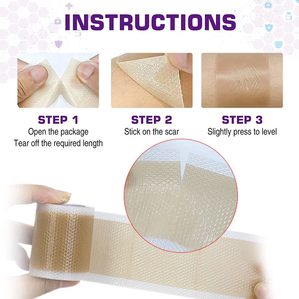 Medical-Grade Silicone Scar Sheets Roll - Reusable Treatment for Keloid, C-Section, Surgery & Burns - Professional Scar Care Solution