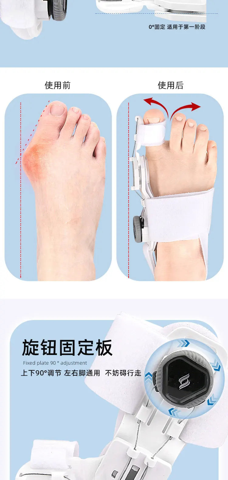 Bunion Corrector for Men & Women – Adjustable Hallux Valgus Toe Separator & Pedicure Straightener
