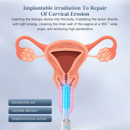 KTS Wireless Vaginal Vibrator Massager with Red Light Therapy for Vaginitis & Vaginal Tightening