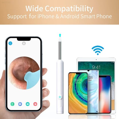 Smart Visual Ear Cleaner 1296P with Camera – USB-C Rechargeable Ear Wax Removal Tool, WiFi, 6 LED Lights