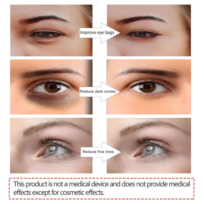 3D EMS Eye Beauty Massager – Micro-Current Pulse Device for Wrinkle Reduction, Dark Circle & Eye Bag Removal