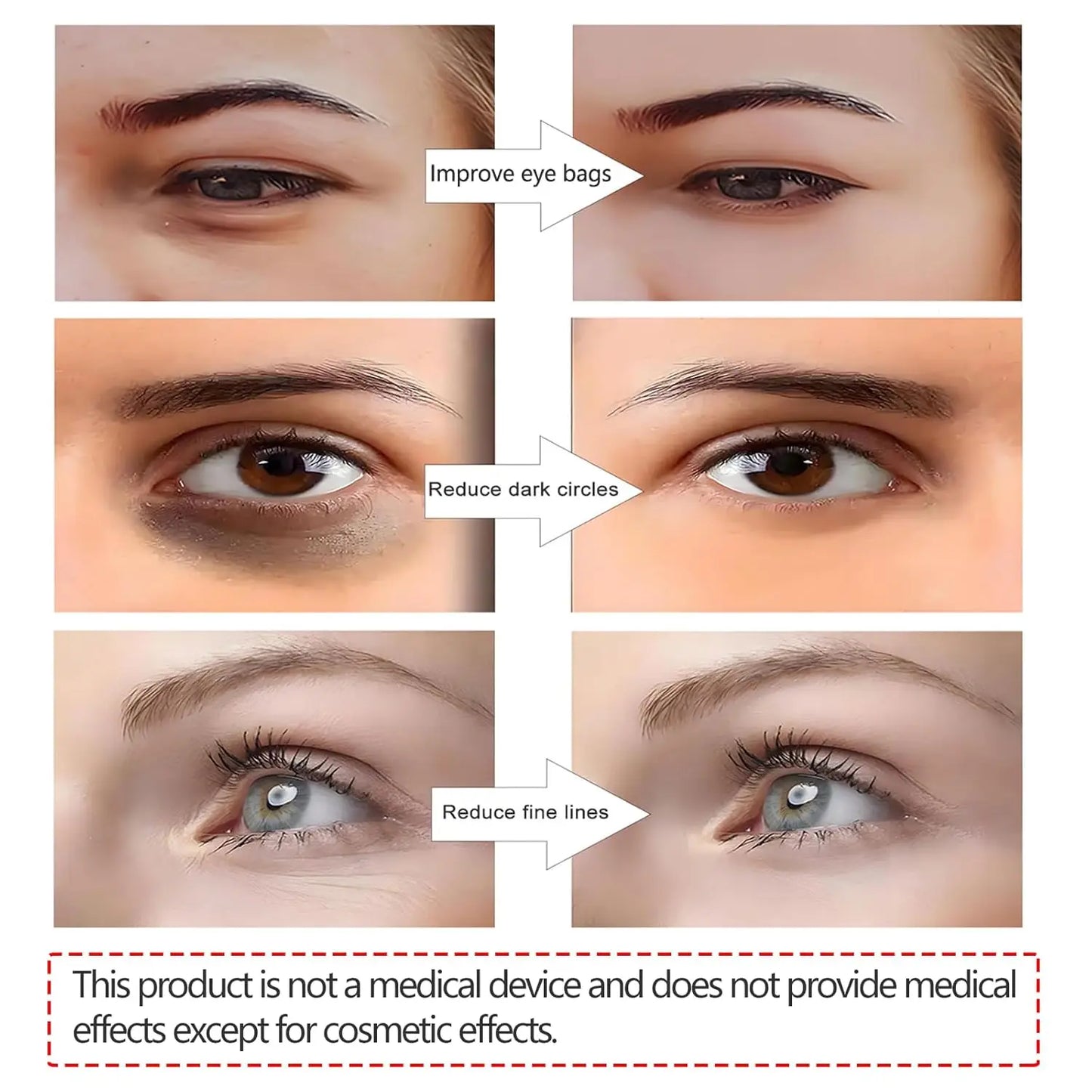 3D EMS Eye Beauty Massager – Micro-Current Pulse Device for Wrinkle Reduction, Dark Circle & Eye Bag Removal