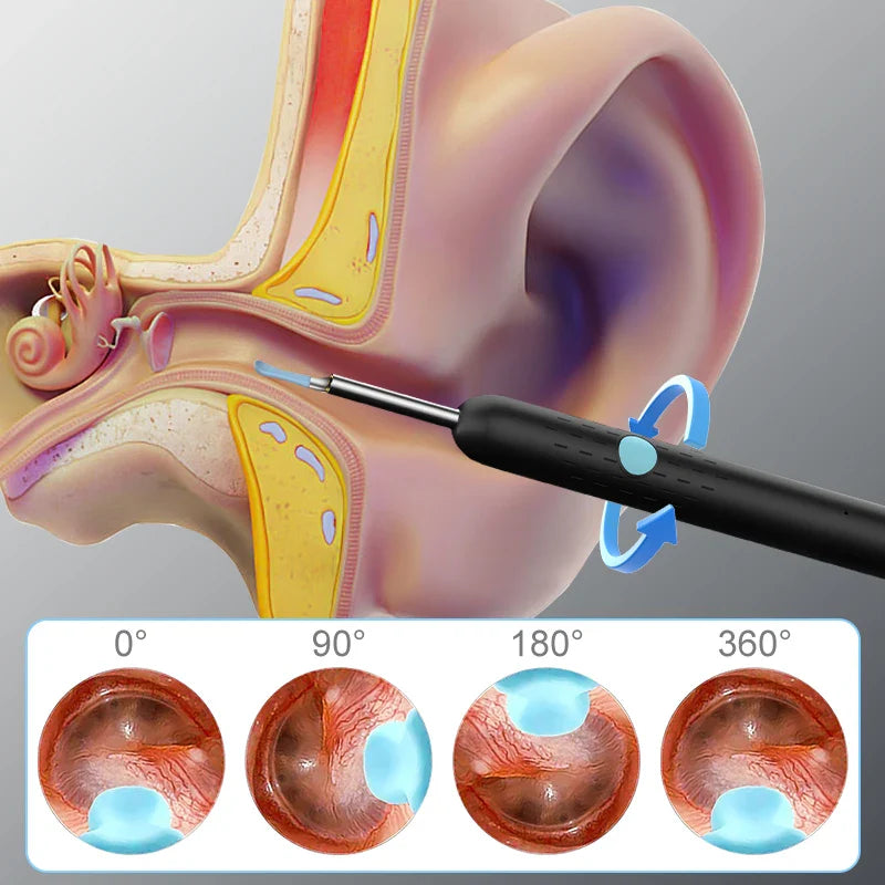 WiFi Visual Ear Sticks – HD 1080P 4.2MM Mini Otoscope Camera, Wireless Ear Picker & Cleaner, Endoscope for Ear Wax Removal & Health Care