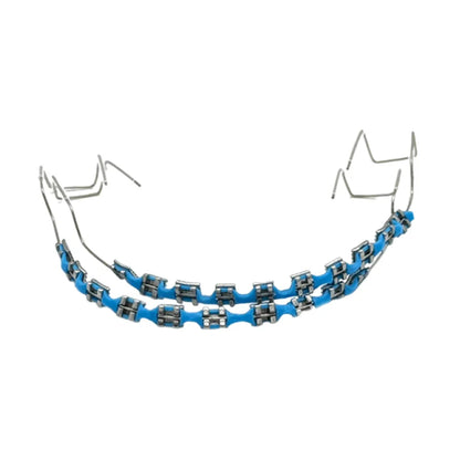 Fashion Temporary Tooth Braces – High-Quality Dental Fake Braces with Metal Wires and Brackets