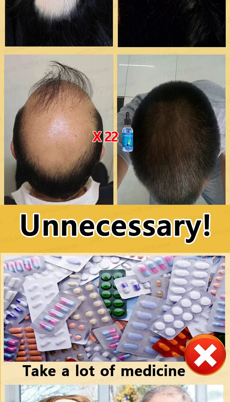 WPRBREGT Blue Hair Growth Serum — Essential Oil for Thicker Hair, Anti-Baldness Treatment
