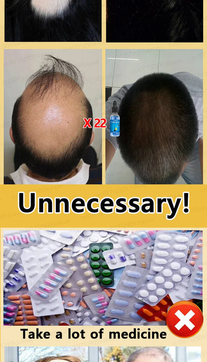 WPRBREGT Blue Hair Growth Serum — Essential Oil for Thicker Hair, Anti-Baldness Treatment