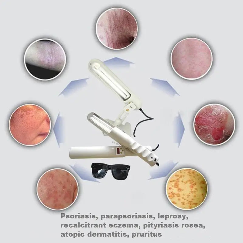 UV 311nm Phototherapy Device – Philips UVB Lamp for Vitiligo, Psoriasis & Skin Treatment