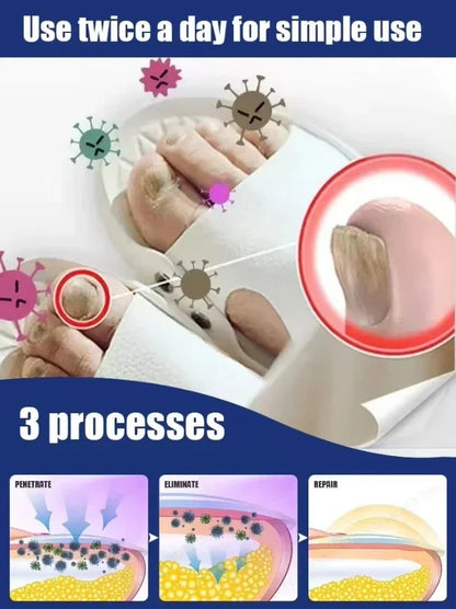 Fast Nail Fungus Treatment Solution – Restore Healthy Looking Nails Quickly & Effectively