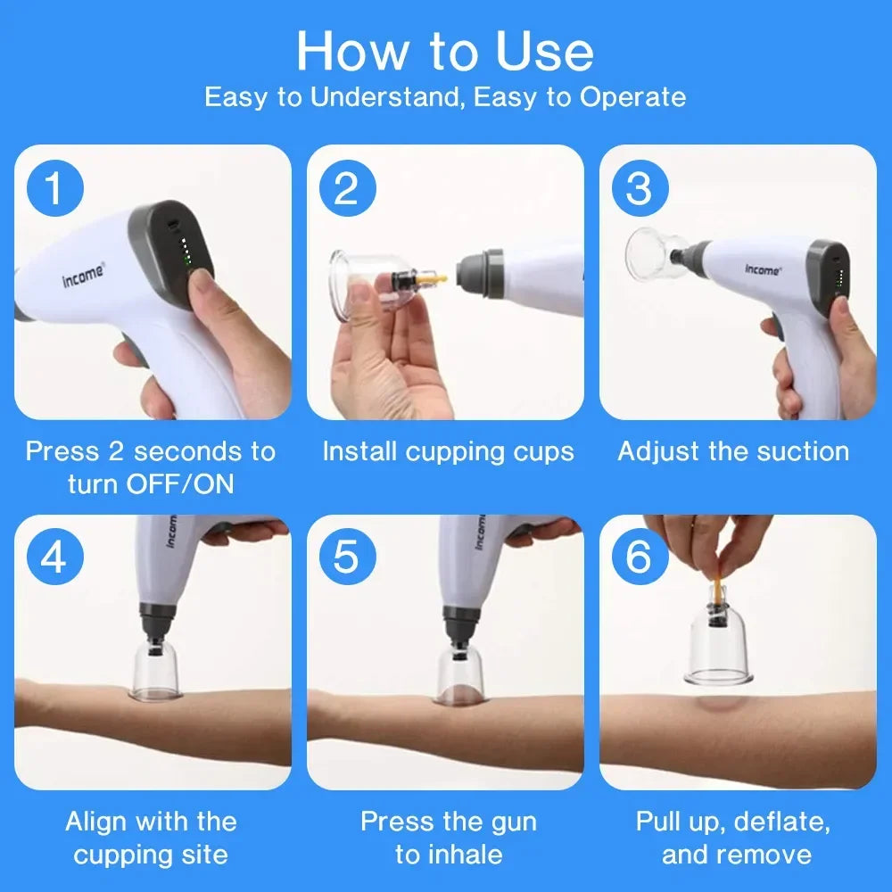 Electric Cupping Machine – Household Vacuum Cupping Set with Easy Suction Gas Tank