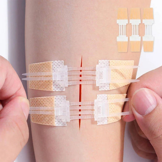 Zipper Wound Closure Patches - Painless Suture-Free Dressing for First Aid and Outdoor Use