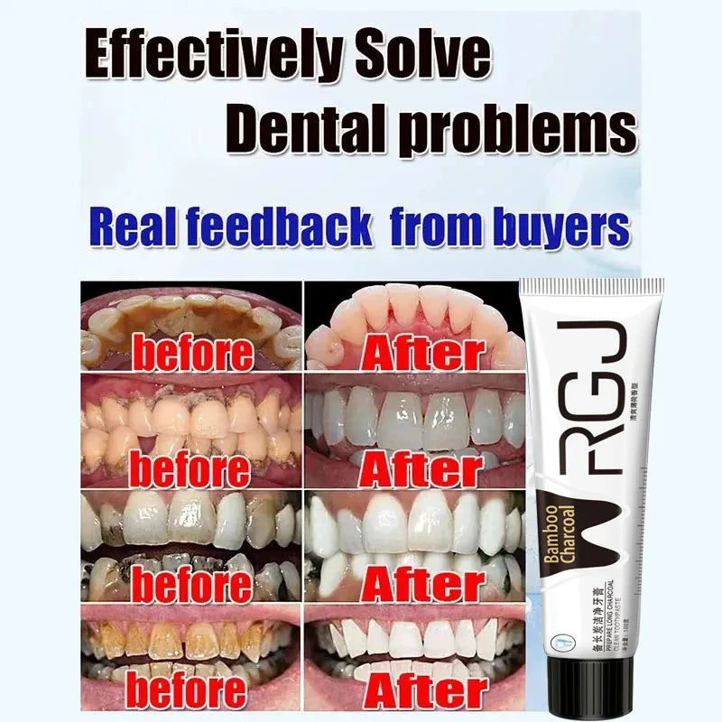 Dental Calculus Remover & Whitening Toothpaste – Fresh Breath & Periodontitis Prevention
