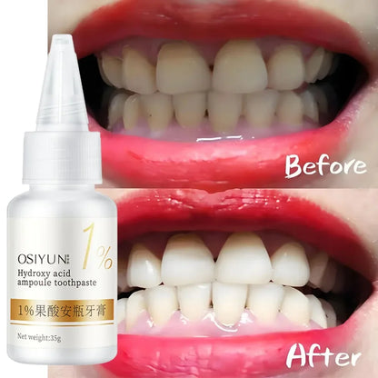 Teeth Whitening Toothpaste – Fruit Acid Formula for Plaque Removal, Stain & Calculus Cleanser, Fresh Breath & Oral Hygiene