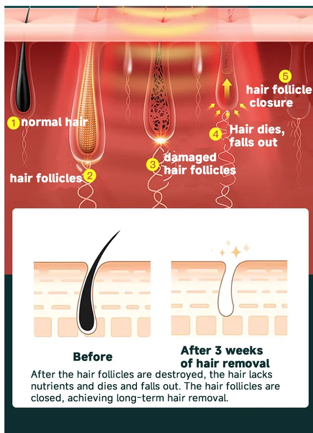 IPL Laser Hair Removal Device – 999,999 Flashes Painless Epilator for Women, Permanent At-Home Bikini & Body Hair Removal