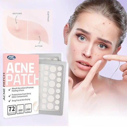 72pcs Invisible Anti-Acne Pimple Patches – Hydrocolloid Waterproof Spot & Mark Repair Stickers