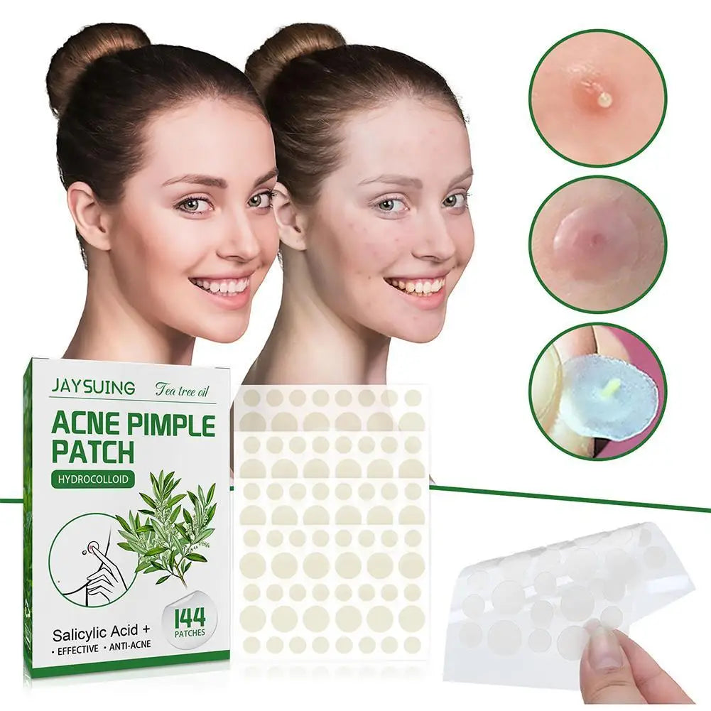 144 Pack Acne Pimple Patches – Translucent Matte Hydrocolloid with Salicylic Acid & Tea Tree Oil for Whiteheads & Inflamed Acne
