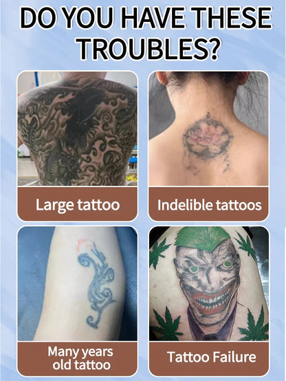 Quick Tattoo Removal Cream – Effective for Pigmented & Permanent Makeup Tattoo Removal