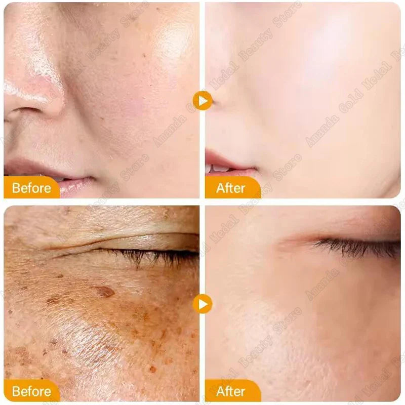 Turmeric & Kojic Acid Facial Cleansing Pads — Lemon Deep Cleanse, Brightening & Whitening Cotton Pads for Face Skincare
