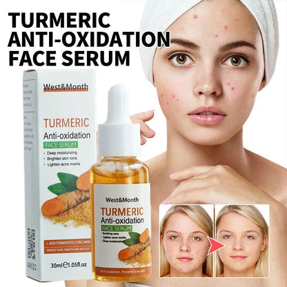 Turmeric Face Whitening Serum – Anti-Oxidation Dark Spot Corrector for Facial Brightening & Skin Clarity