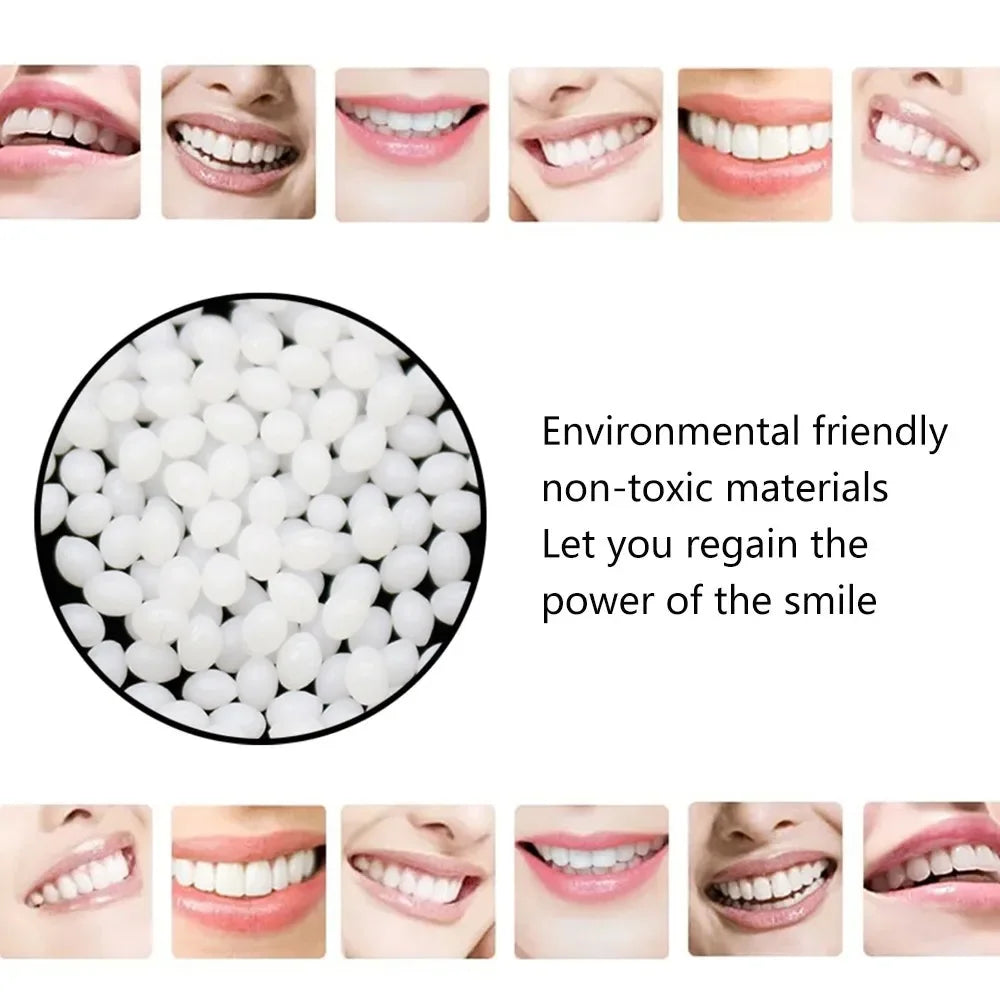 Temporary Tooth Repair Beads – Food Grade Dental Filling Material for Missing or Broken Teeth, False Teeth Glue, Denture Repair