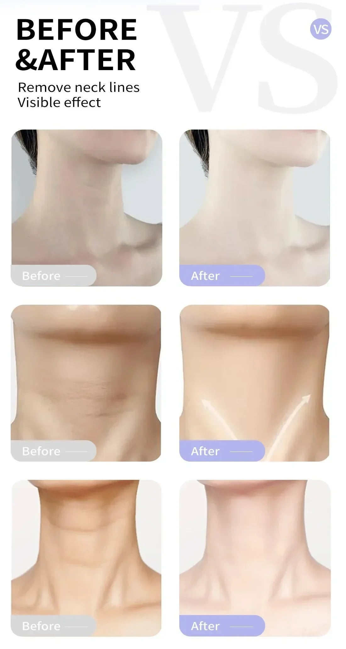 Rtopr Neck Cream — Reinforced Wrinkle Removal, Whitening & Moisturizing, Rejuvenating Neck Skincare